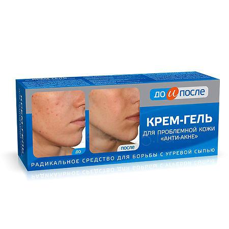 До и После Анти-акне крем-гель для проблемной кожи 50 мл